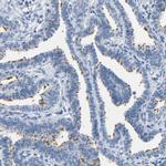 CCRD6 Antibody in Immunohistochemistry (Paraffin) (IHC (P))