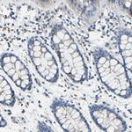 CCRD6 Antibody in Immunohistochemistry (Paraffin) (IHC (P))