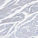 CCRD6 Antibody in Immunohistochemistry (Paraffin) (IHC (P))