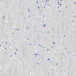 CD20 Antibody in Immunohistochemistry (Paraffin) (IHC (P))
