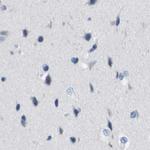 CD20 Antibody in Immunohistochemistry (Paraffin) (IHC (P))