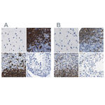 CD20 Antibody in Immunohistochemistry (Paraffin) (IHC (P))