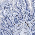CD20 Antibody in Immunohistochemistry (Paraffin) (IHC (P))