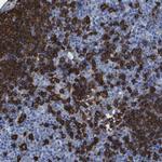 CD20 Antibody in Immunohistochemistry (Paraffin) (IHC (P))