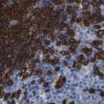 CD20 Antibody in Immunohistochemistry (Paraffin) (IHC (P))