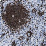CD20 Antibody in Immunohistochemistry (Paraffin) (IHC (P))