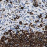 CD20 Antibody in Immunohistochemistry (Paraffin) (IHC (P))