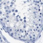 CD20 Antibody in Immunohistochemistry (Paraffin) (IHC (P))