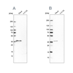 CD20 Antibody in Western Blot (WB)