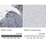 CD20 Antibody in Immunohistochemistry (Paraffin) (IHC (P))