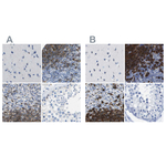CD20 Antibody in Immunohistochemistry (Paraffin) (IHC (P))