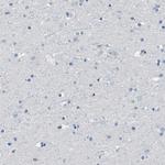 CD20 Antibody in Immunohistochemistry (Paraffin) (IHC (P))