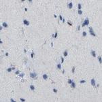CD20 Antibody in Immunohistochemistry (Paraffin) (IHC (P))