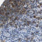 CD20 Antibody in Immunohistochemistry (Paraffin) (IHC (P))