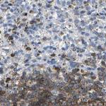 CD20 Antibody in Immunohistochemistry (Paraffin) (IHC (P))