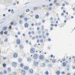 CD20 Antibody in Immunohistochemistry (Paraffin) (IHC (P))