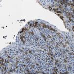 CD20 Antibody in Immunohistochemistry (Paraffin) (IHC (P))