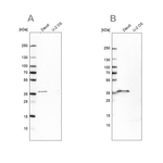 CD20 Antibody in Western Blot (WB)