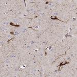 TAC1 Polyclonal Antibody