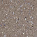 GluR6 Polyclonal Antibody