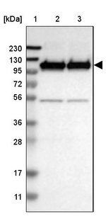 GluR6 Antibody in Western Blot (WB)