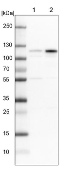 GluR6 Antibody in Western Blot (WB)