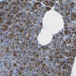 SYNGR2 Antibody in Immunohistochemistry (Paraffin) (IHC (P))