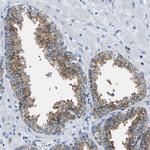 SYNGR2 Antibody in Immunohistochemistry (Paraffin) (IHC (P))