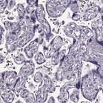 TRPM1 Antibody in Immunohistochemistry (Paraffin) (IHC (P))