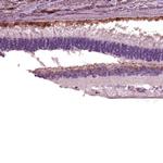 TRPM1 Polyclonal Antibody