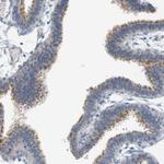 CREB3L2 Polyclonal Antibody