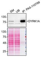 DYRK1A Antibody in Immunoprecipitation (IP)