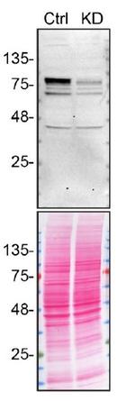 DYRK1A Antibody in Western Blot (WB)