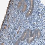 DYRK1A Antibody in Immunohistochemistry (Paraffin) (IHC (P))