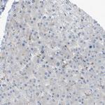 DYRK1A Antibody in Immunohistochemistry (Paraffin) (IHC (P))