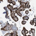 DYRK1A Antibody in Immunohistochemistry (Paraffin) (IHC (P))