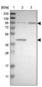 DYRK1A Antibody in Western Blot (WB)