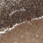 Calcium Channel beta-4 Polyclonal Antibody