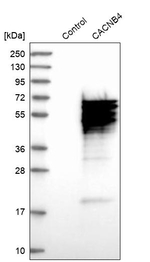 Calcium Channel beta-4 Antibody in Western Blot (WB)