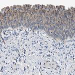 EMR3 Polyclonal Antibody