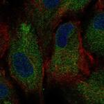 PKD2 Polyclonal Antibody