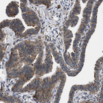 PKD2 Antibody in Immunohistochemistry (Paraffin) (IHC (P))