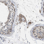 PKD2 Antibody in Immunohistochemistry (Paraffin) (IHC (P))