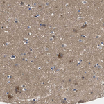 PKD2 Antibody in Immunohistochemistry (Paraffin) (IHC (P))