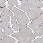 PKD2 Antibody in Immunohistochemistry (Paraffin) (IHC (P))