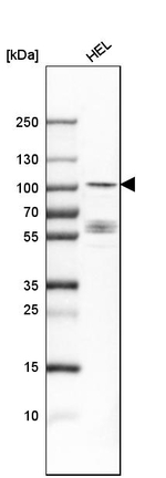 DYRK1A Antibody in Western Blot (WB)