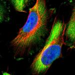 HSPB8 Polyclonal Antibody