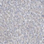 HSPB8 Antibody in Immunohistochemistry (Paraffin) (IHC (P))