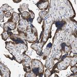 HSPB8 Antibody in Immunohistochemistry (Paraffin) (IHC (P))