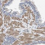 HSPB8 Antibody in Immunohistochemistry (Paraffin) (IHC (P))